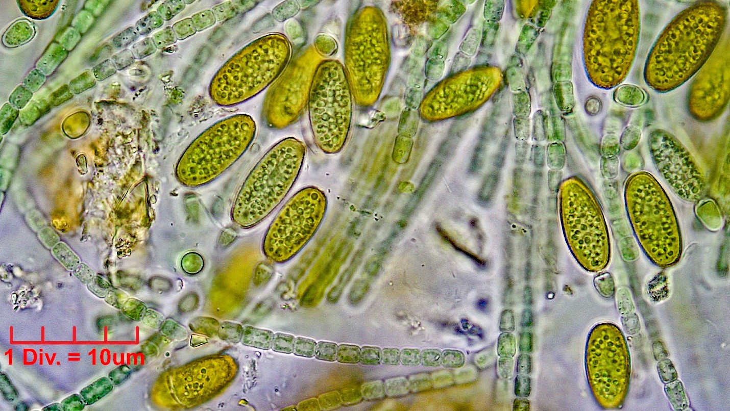 ././././Cyanobacteria/Nostocales/Nostocaceae/Cylindrospermum/stagnale/cylindrospermum-stagnale-633.jpg