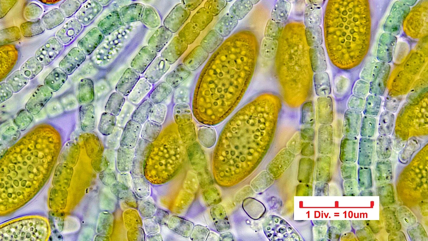 ././././Cyanobacteria/Nostocales/Nostocaceae/Cylindrospermum/stagnale/cylindrospermum-stagnale-634.jpg