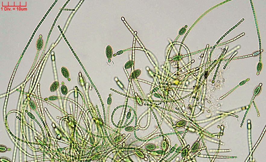 ././Cyanobacteria/Nostocales/Nostocaceae/Cylindrospermum/stagnale/cylindrospermum-stagnale-635.png