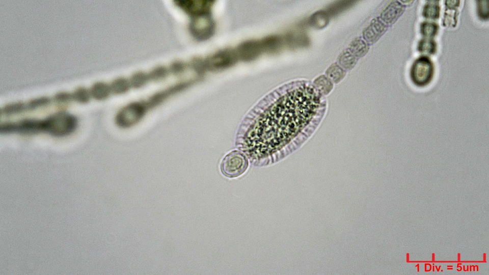 ././././Cyanobacteria/Nostocales/Nostocaceae/Cylindrospermum/stagnale/cylindrospermum-stagnale-636.png