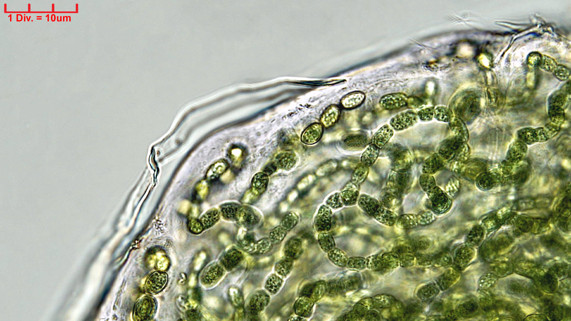 Cyanobacteria/Nostocales/Nostocaceae/Desmonostoc/muscorum/desmonostoc-muscorum-591.jpg