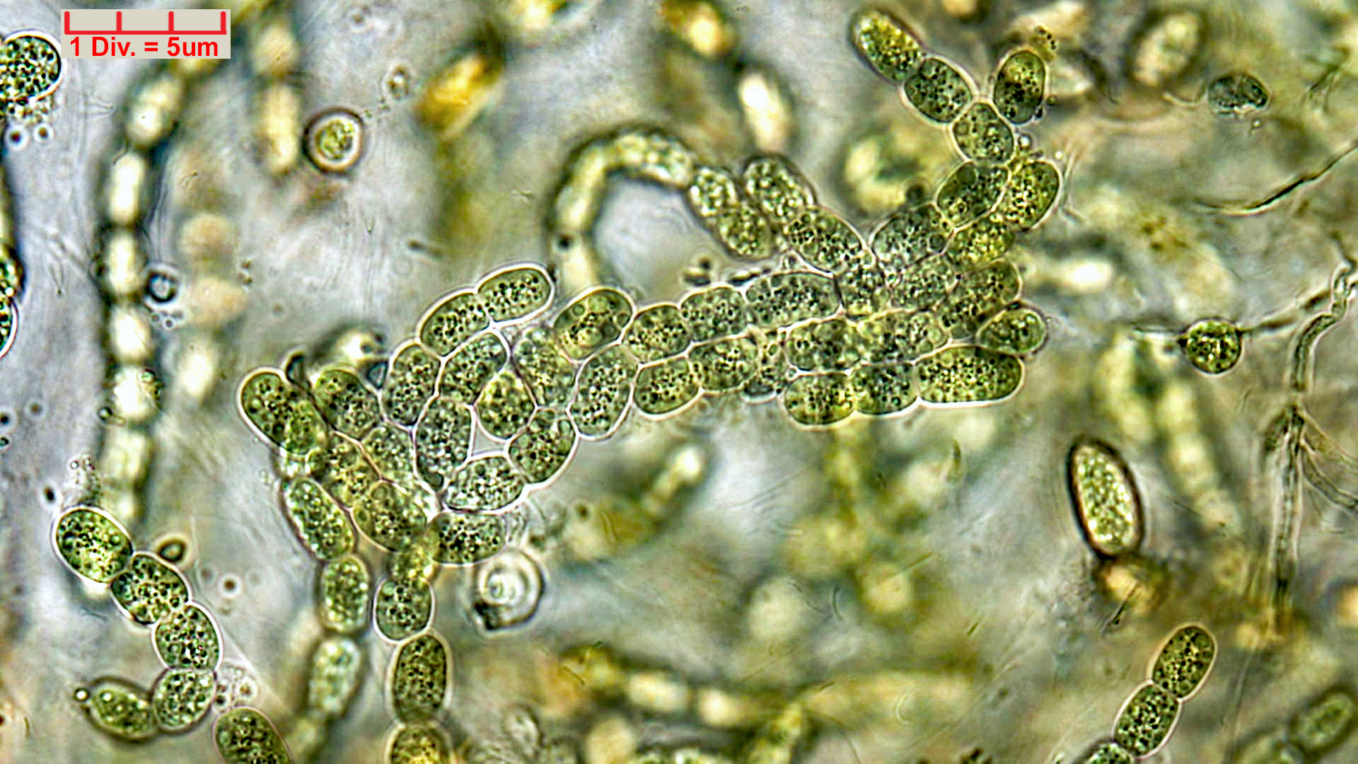 ././././Cyanobacteria/Nostocales/Nostocaceae/Desmonostoc/muscorum/desmonostoc-muscorum-592.jpg