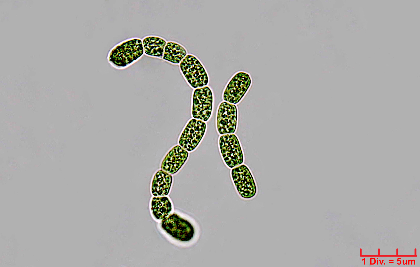 Cyanobacteria/Nostocales/Nostocaceae/Desmonostoc/muscorum/desmonostoc-muscorum-593.jpg
