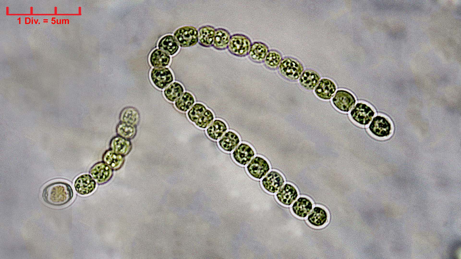 Cyanobacteria/Nostocales/Nostocaceae/Nostoc/commune/nostoc-commune-600.jpg