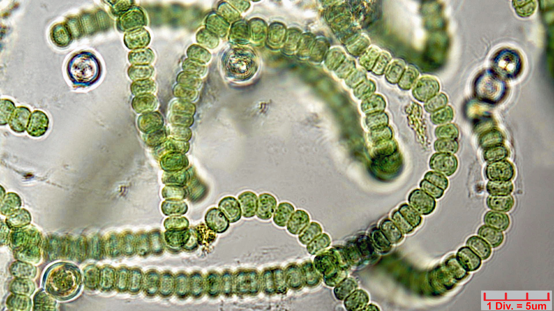 Cyanobacteria/Nostocales/Nostocaceae/Nostoc/kihlmanii/nostoc-kihlmanii-616.jpg