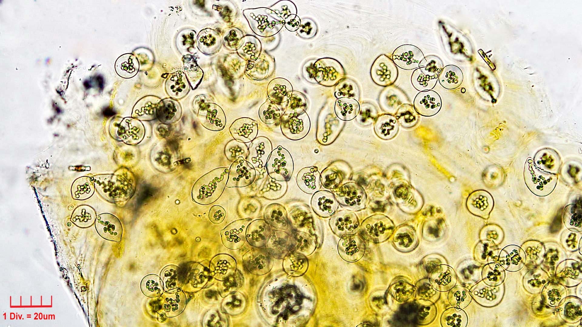 ./Cyanobacteria/Nostocales/Nostocaceae/Nostoc/microscopicum/nostoc-microscopicum-605.jpg