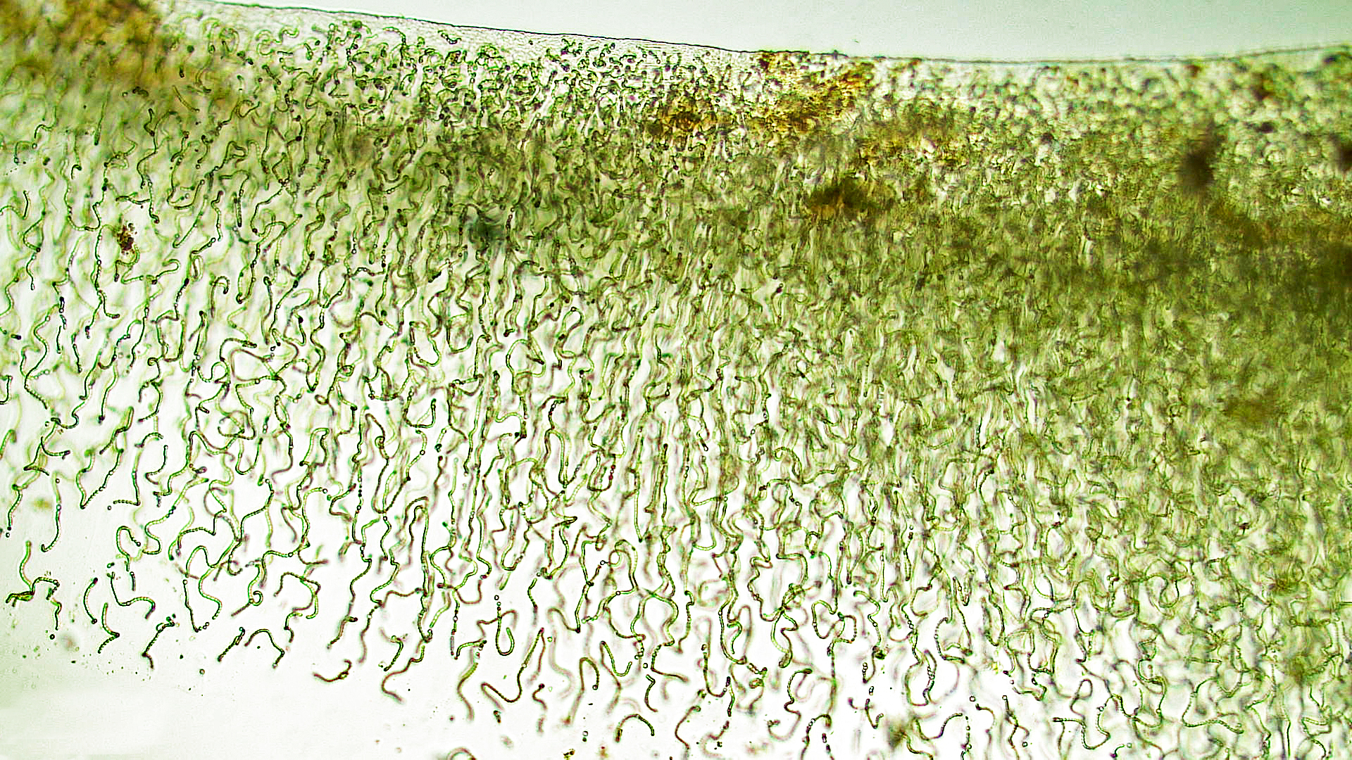 ././Cyanobacteria/Nostocales/Nostocaceae/Nostoc/pruniforme/nostoc-pruniforme-3.jpg