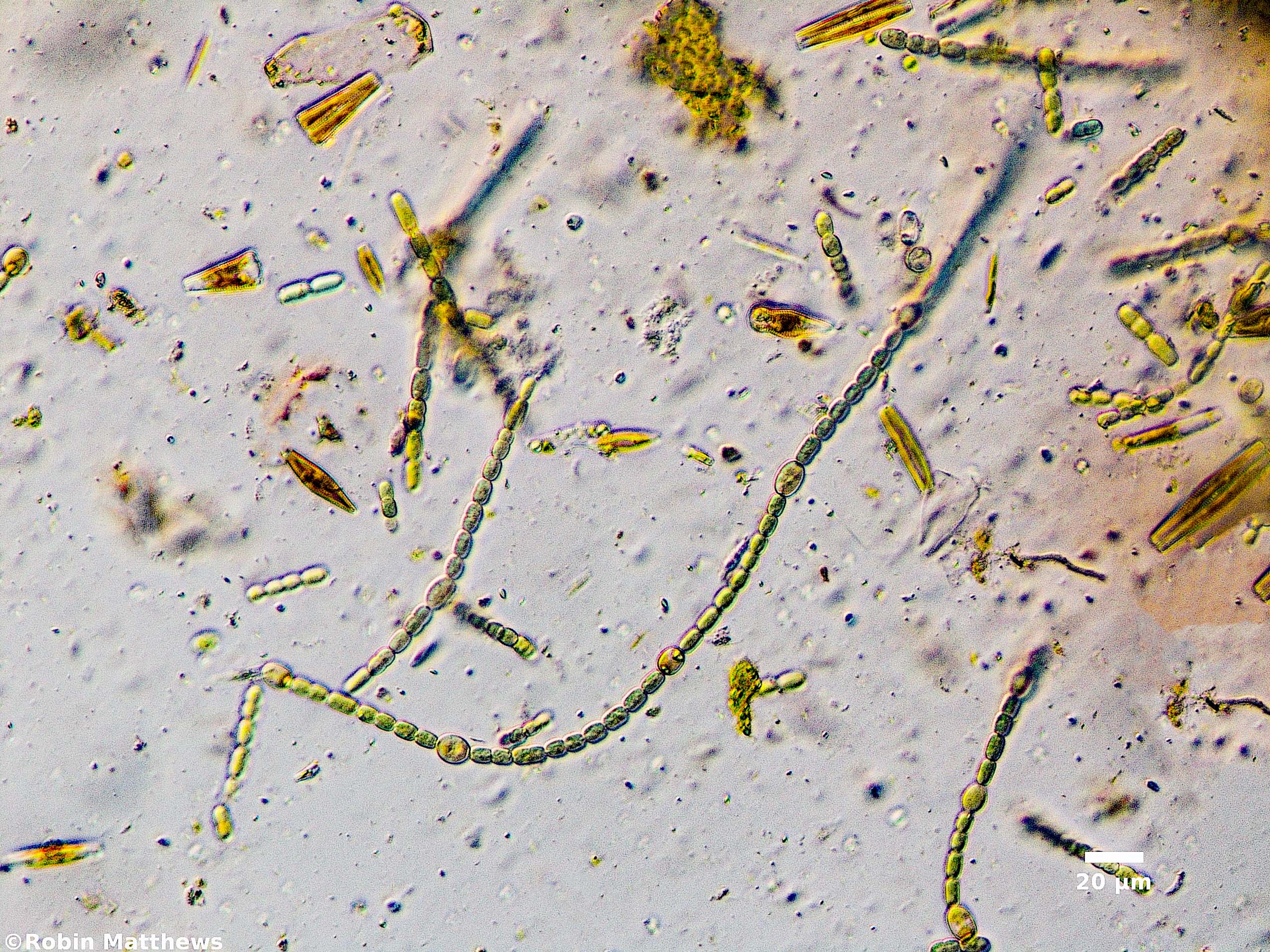 ././Cyanobacteria/Nostocales/Nostocaceae/Trichormus/azollae/trichormus-azollae-629.jpg
