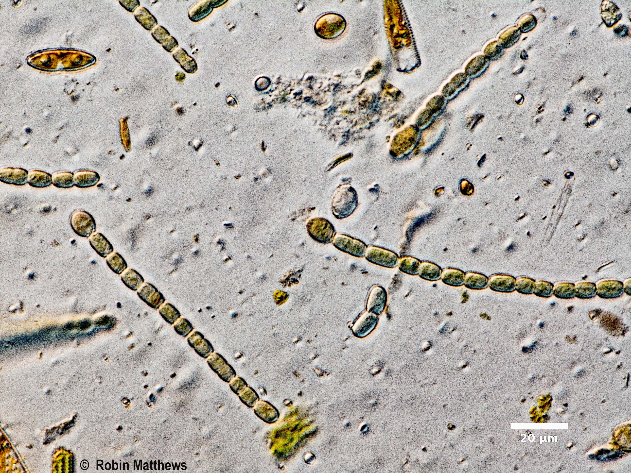 ./././Cyanobacteria/Nostocales/Nostocaceae/Trichormus/azollae/trichormus-azollae-630.jpg