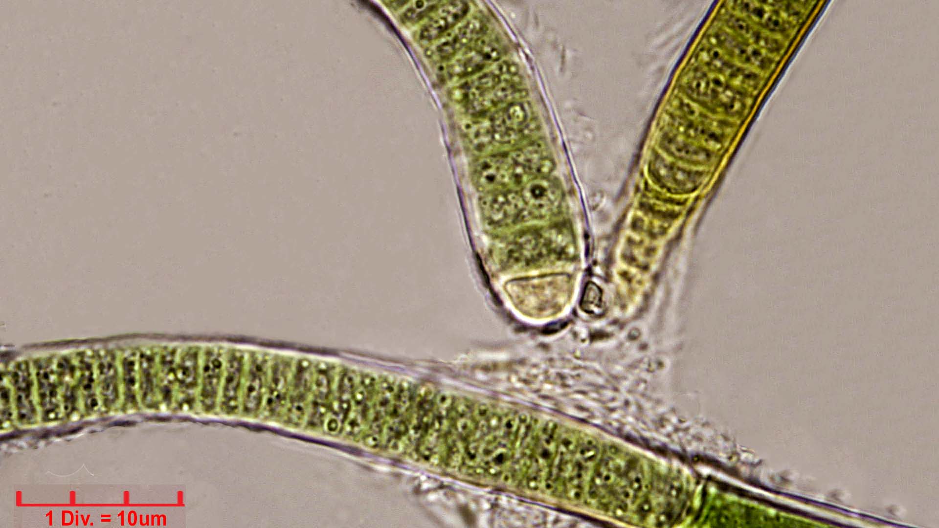 ./Cyanobacteria/Nostocales/Rivulariaceae/Calothrix/confervicola/calothrix-confervicola-445.jpg