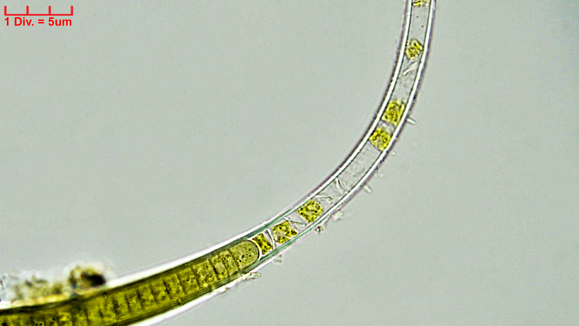 Cyanobacteria/Nostocales/Rivulariaceae/Calothrix/fusca/calothrix-fusca-437.jpg