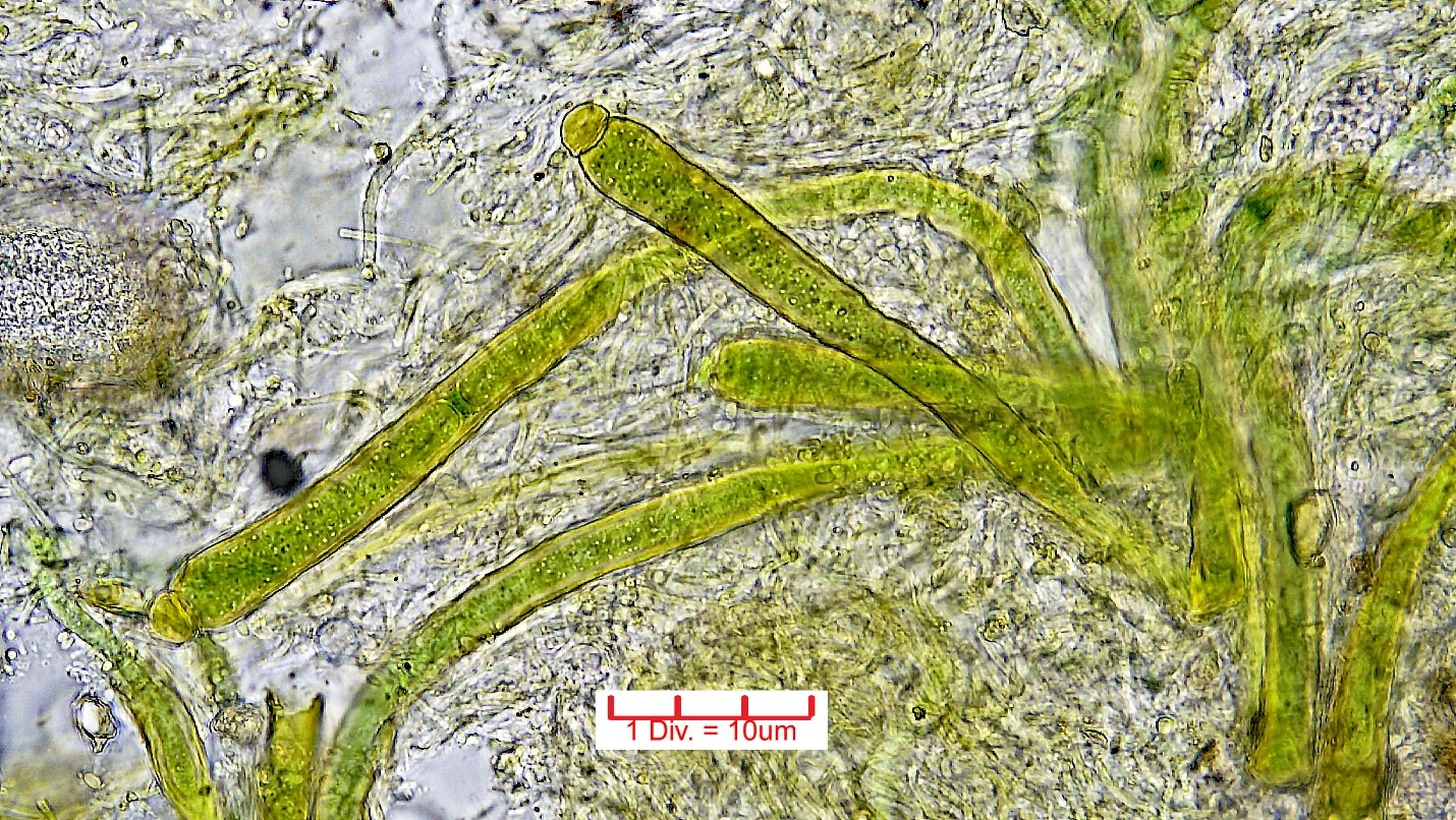 ./././Cyanobacteria/Nostocales/Rivulariaceae/Calothrix/parietina/calothrix-parietina-438.jpg
