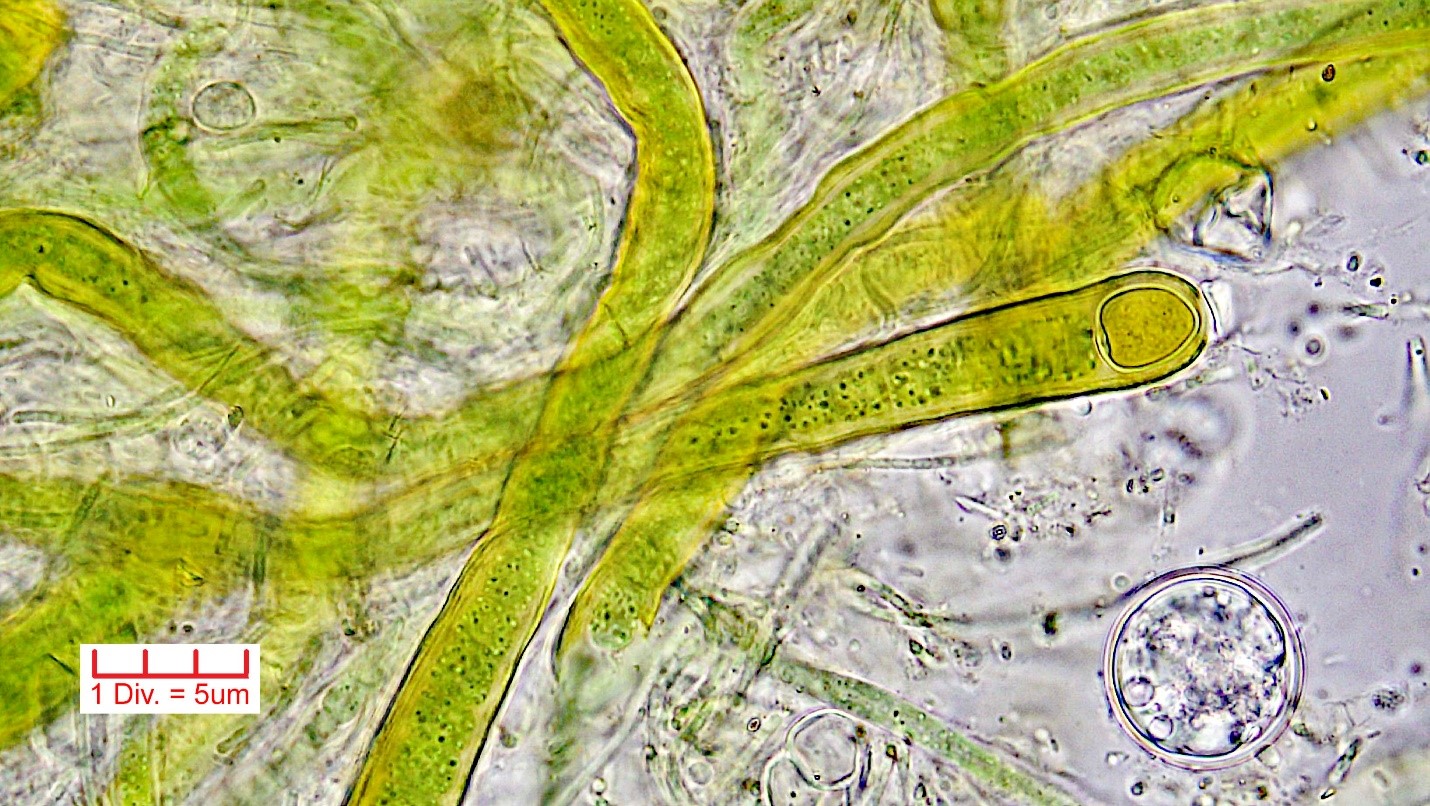 Cyanobacteria/Nostocales/Rivulariaceae/Calothrix/parietina/calothrix-parietina-439.jpg