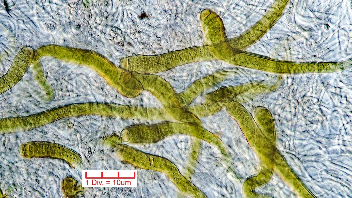Cyanobacteria/Nostocales/Rivulariaceae/Calothrix/parietina/calothrix-parietina-441.jpg