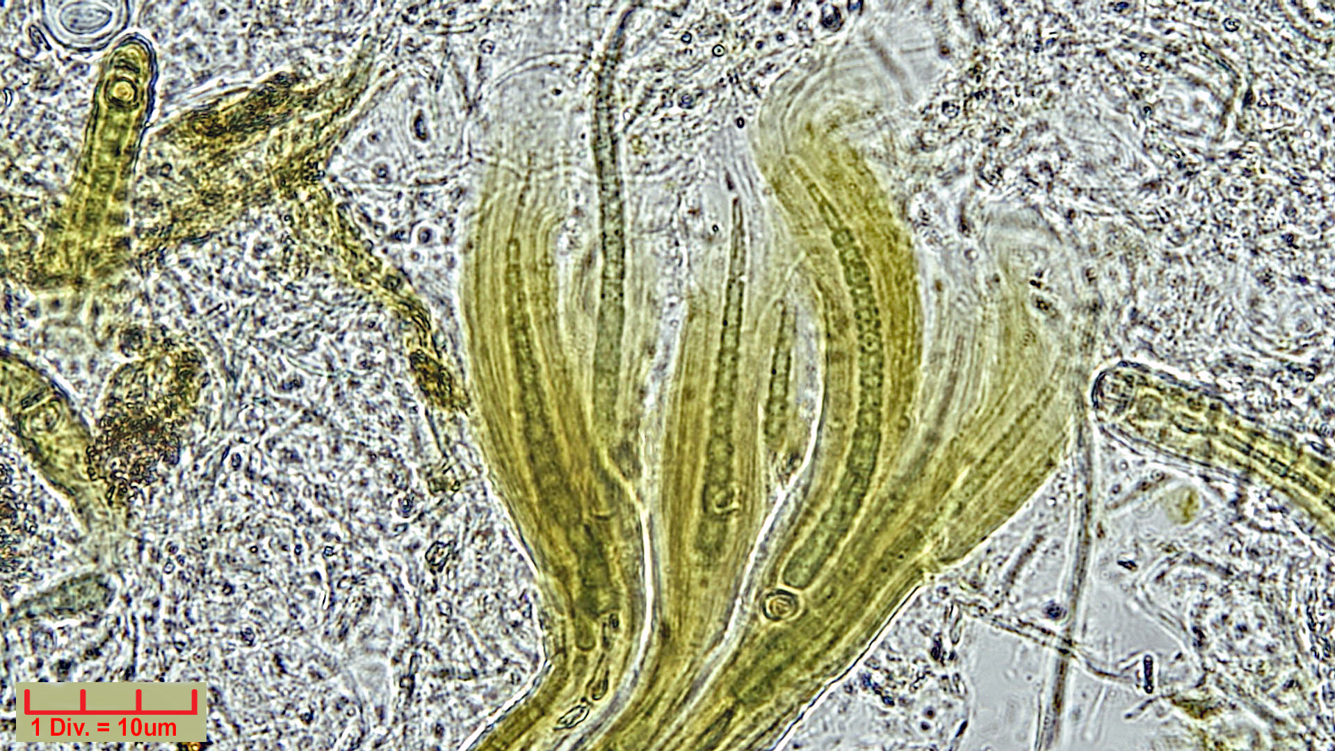 ./Cyanobacteria/Nostocales/Rivulariaceae/Dichothrix/gypsophila/dichothrix-gypsophila-458.jpg