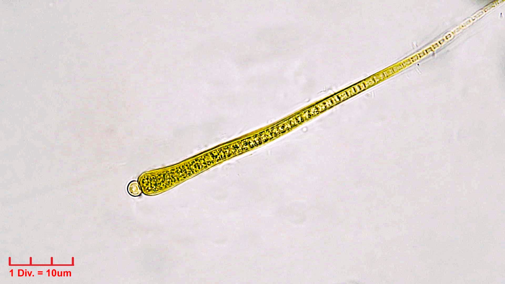 ././Cyanobacteria/Nostocales/Rivulariaceae/Isactis/fluviatilis_cf/isactis-fluviatilis-454.jpg