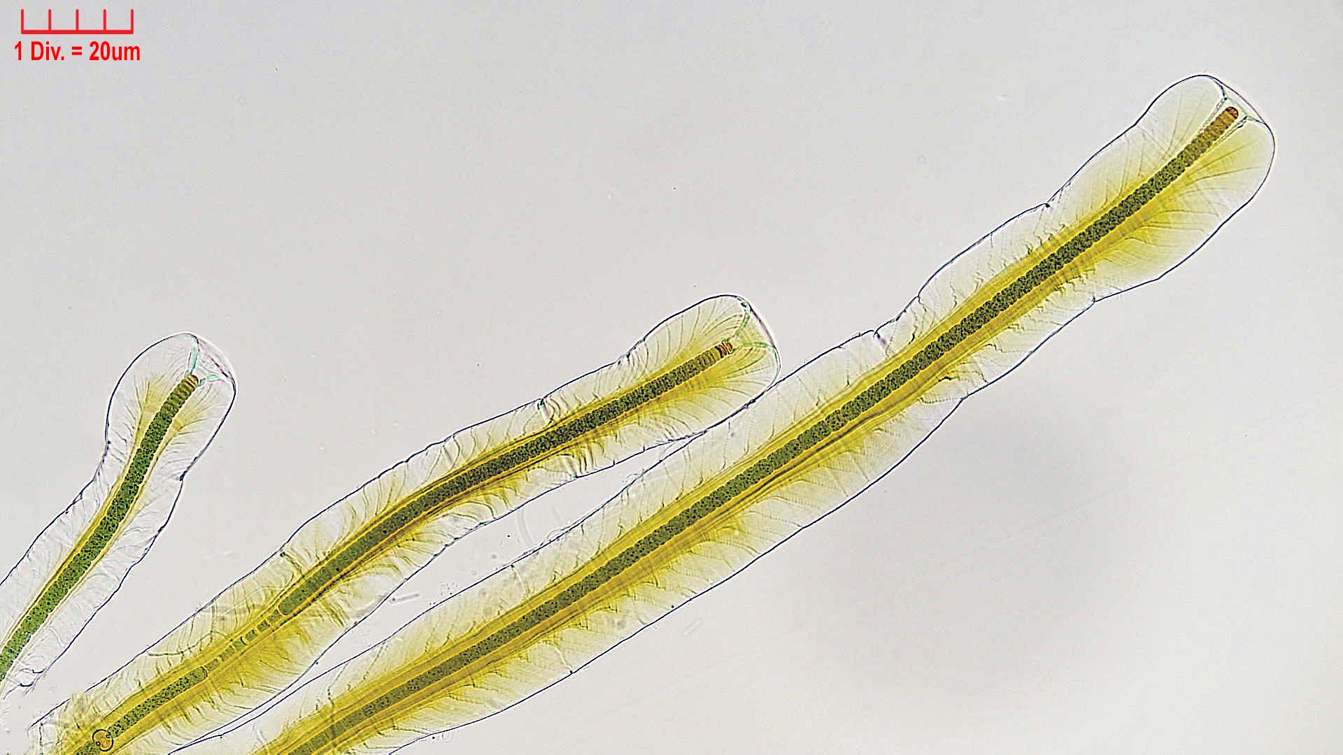 Cyanobacteria/Nostocales/Scytonemataceae/Petalonema/alatum/petalonema-alatum-406.jpg