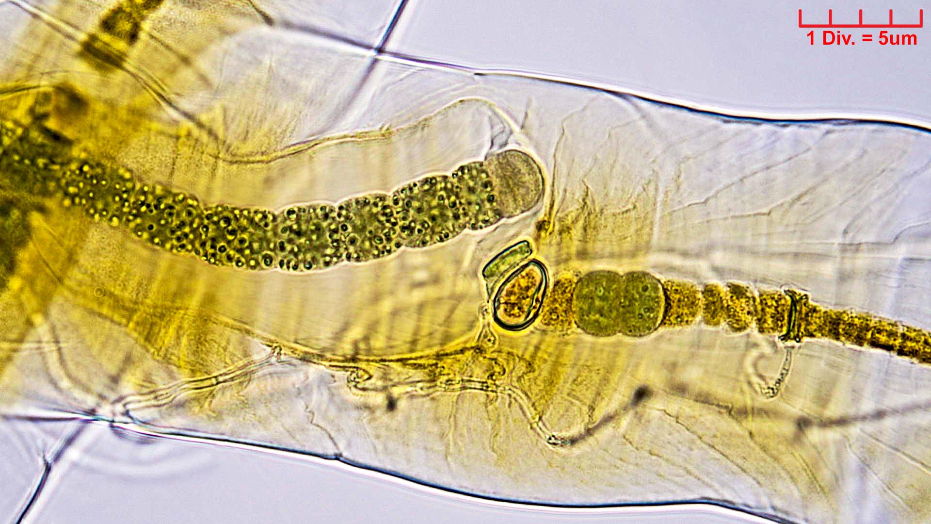 ././Cyanobacteria/Nostocales/Scytonemataceae/Petalonema/alatum/petalonema-alatum-409.jpg