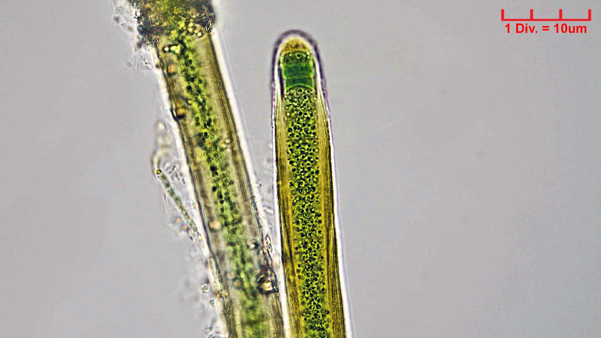 Cyanobacteria/Nostocales/Scytonemataceae/Petalonema/alatum/petalonema-alatum-411.jpg