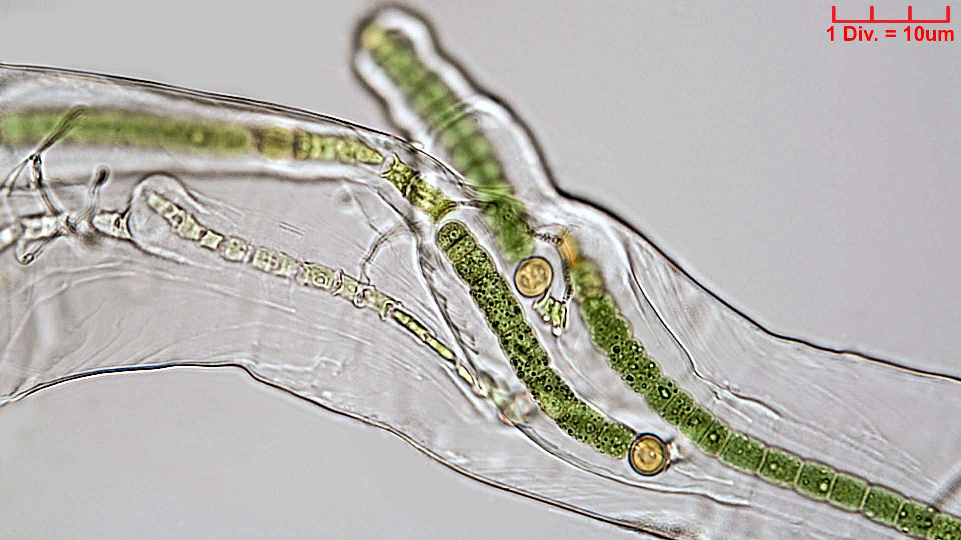 ././Cyanobacteria/Nostocales/Scytonemataceae/Petalonema/alatum/petalonema-alatum-412.jpg