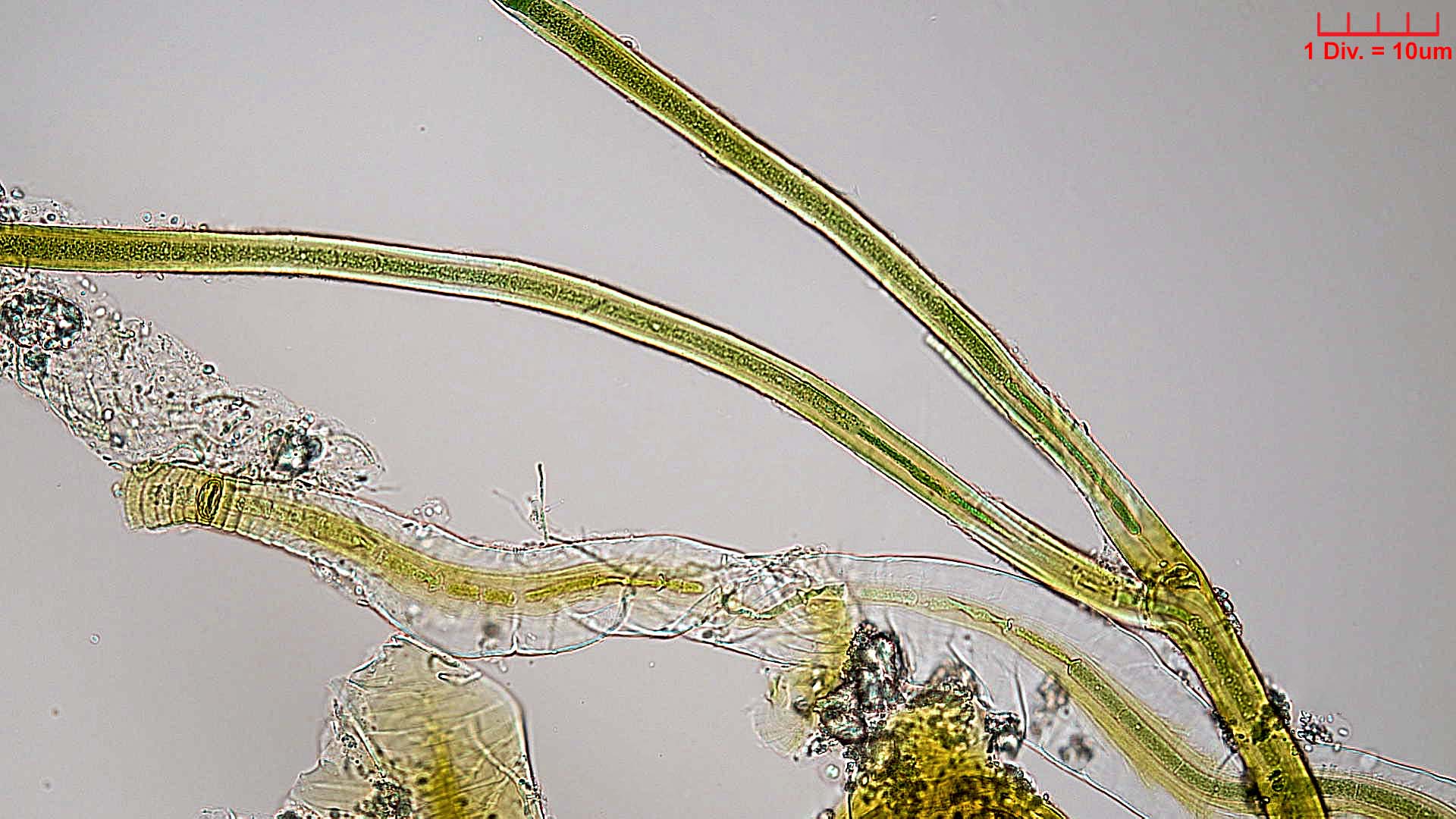 ././Cyanobacteria/Nostocales/Scytonemataceae/Petalonema/alatum/petalonema-alatum-413.jpg