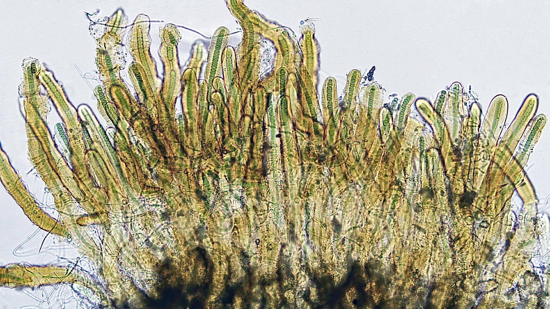 Cyanobacteria/Nostocales/Scytonemataceae/Petalonema/densum/petalonema-densum-1.jpg