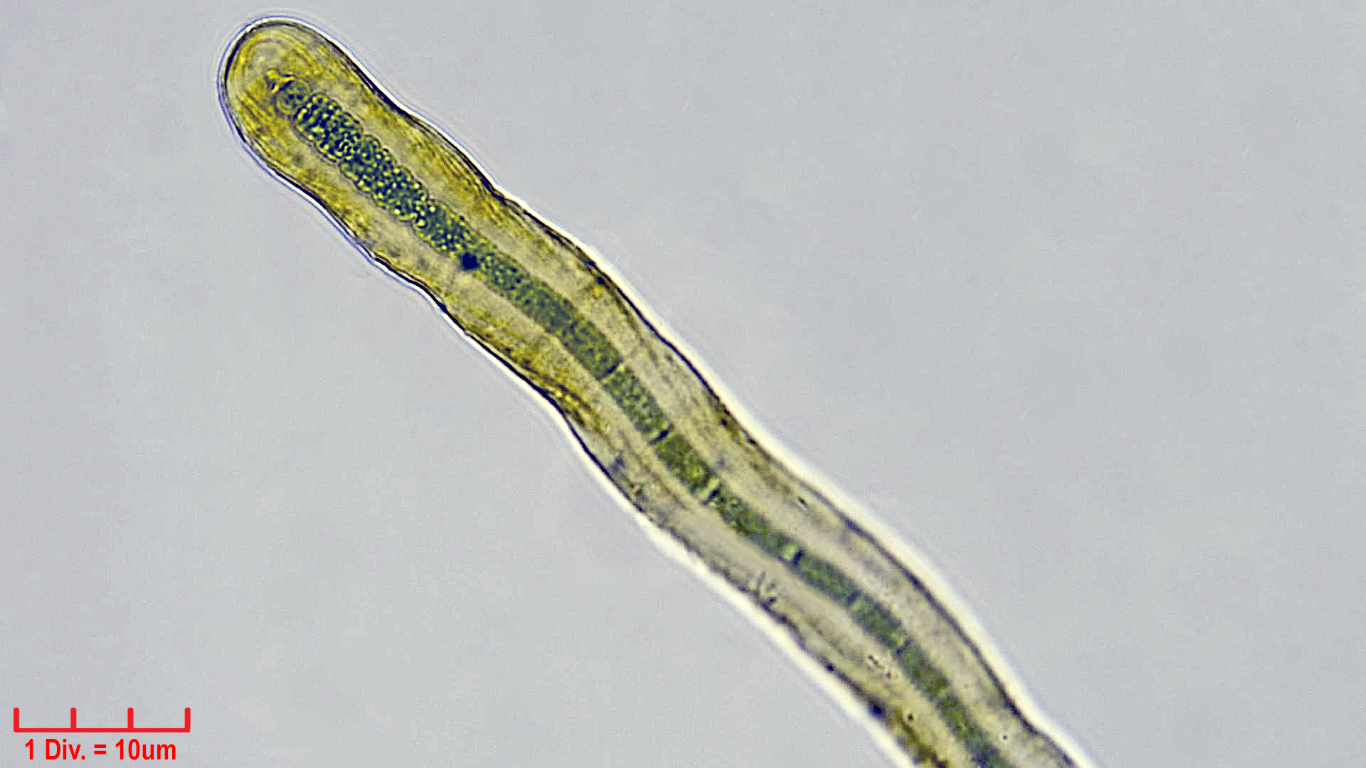 Cyanobacteria/Nostocales/Scytonemataceae/Petalonema/densum/petalonema-densum-5.jpg
