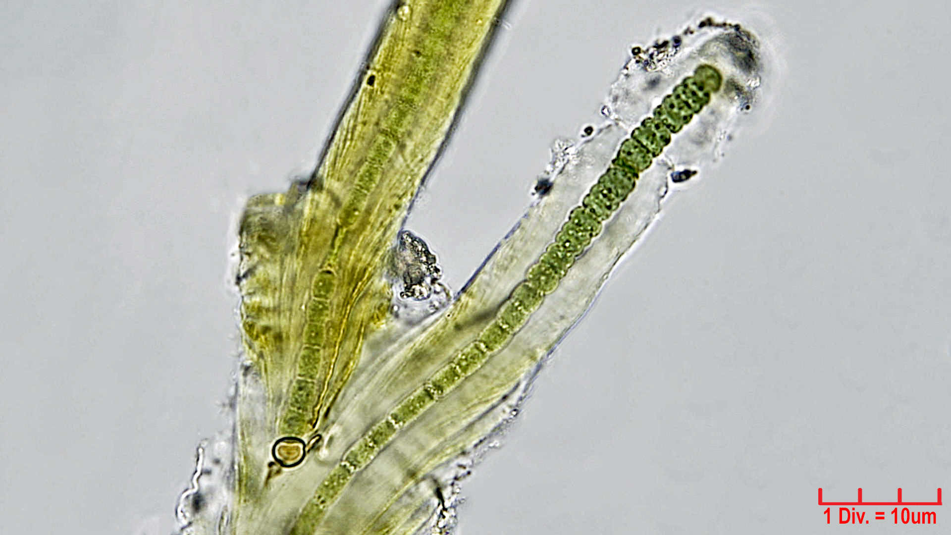 ././././Cyanobacteria/Nostocales/Scytonemataceae/Petalonema/densum/petalonema-densum-7.jpg