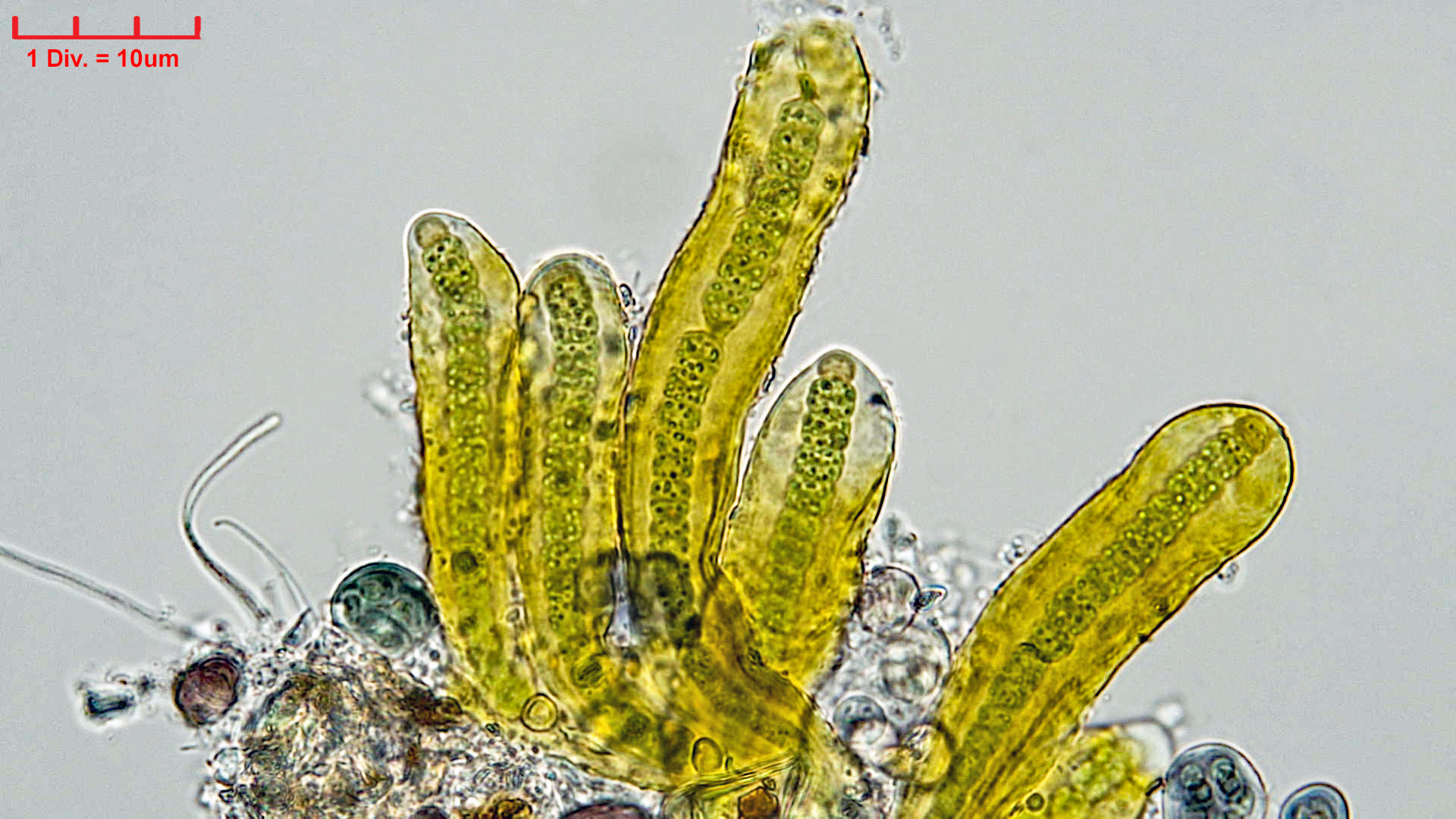 ././Cyanobacteria/Nostocales/Scytonemataceae/Petalonema/incrustans/petalonema-incrustans-415.jpg