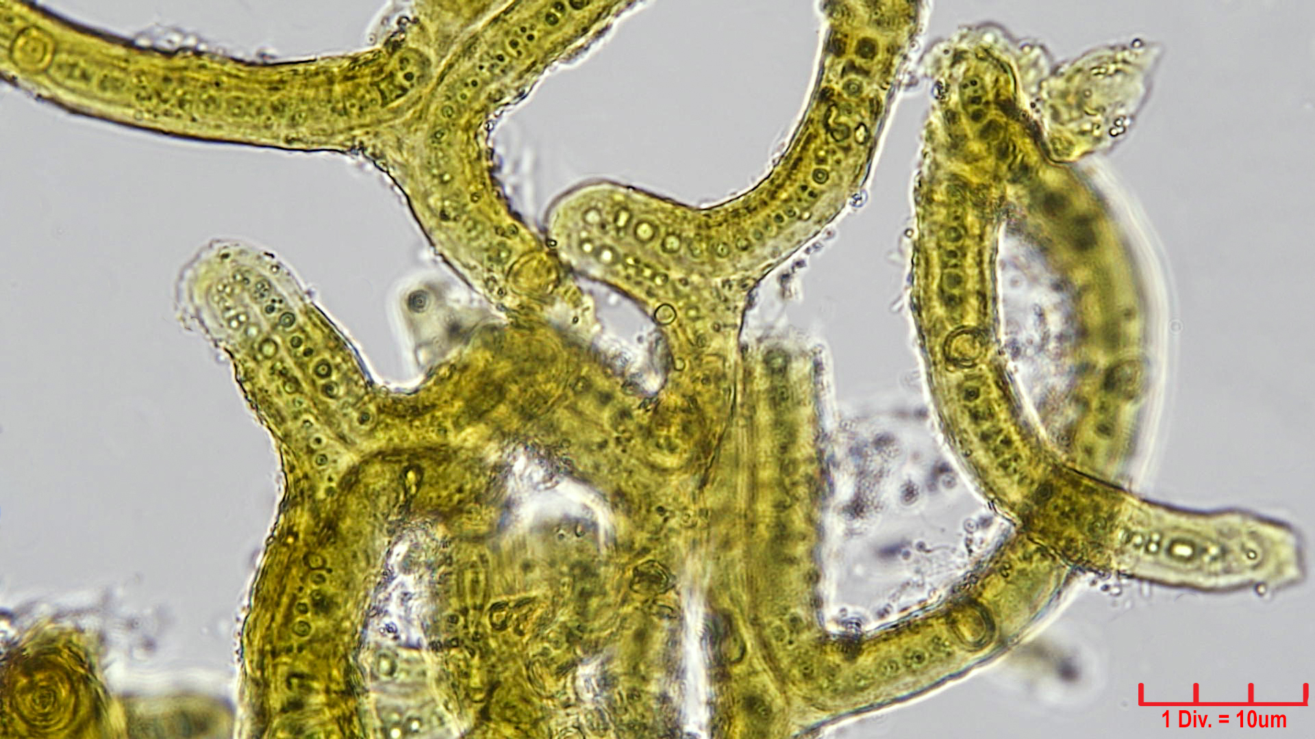 ././././Cyanobacteria/Nostocales/Scytonemataceae/Petalonema/incrustans/petalonema-incrustans-417.jpg