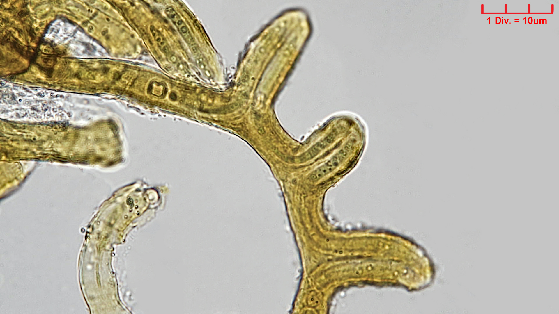 Cyanobacteria/Nostocales/Scytonemataceae/Petalonema/incrustans/petalonema-incrustans-418.jpg