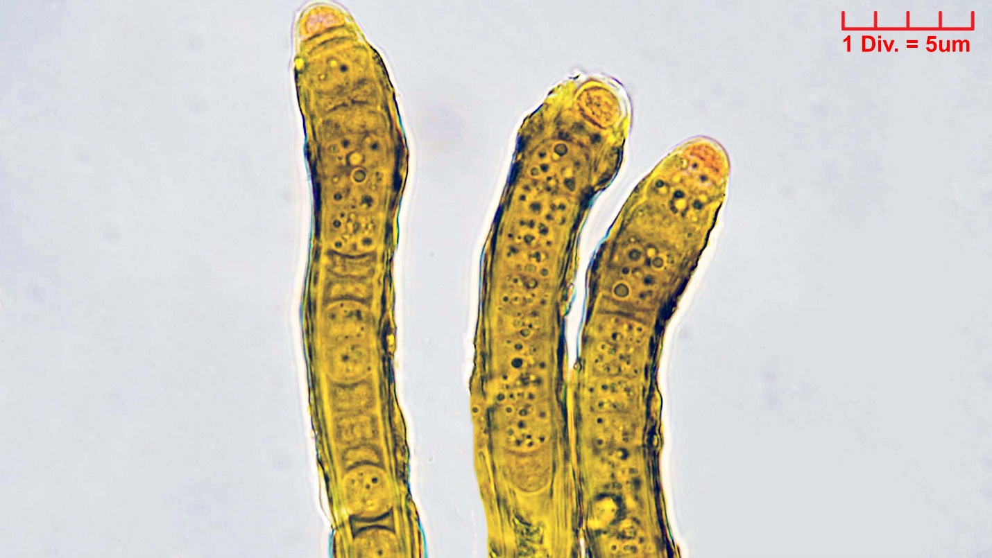 Cyanobacteria/Nostocales/Scytonemataceae/Scytonema/hofmannii/scytonema-hofmannii-391.png
