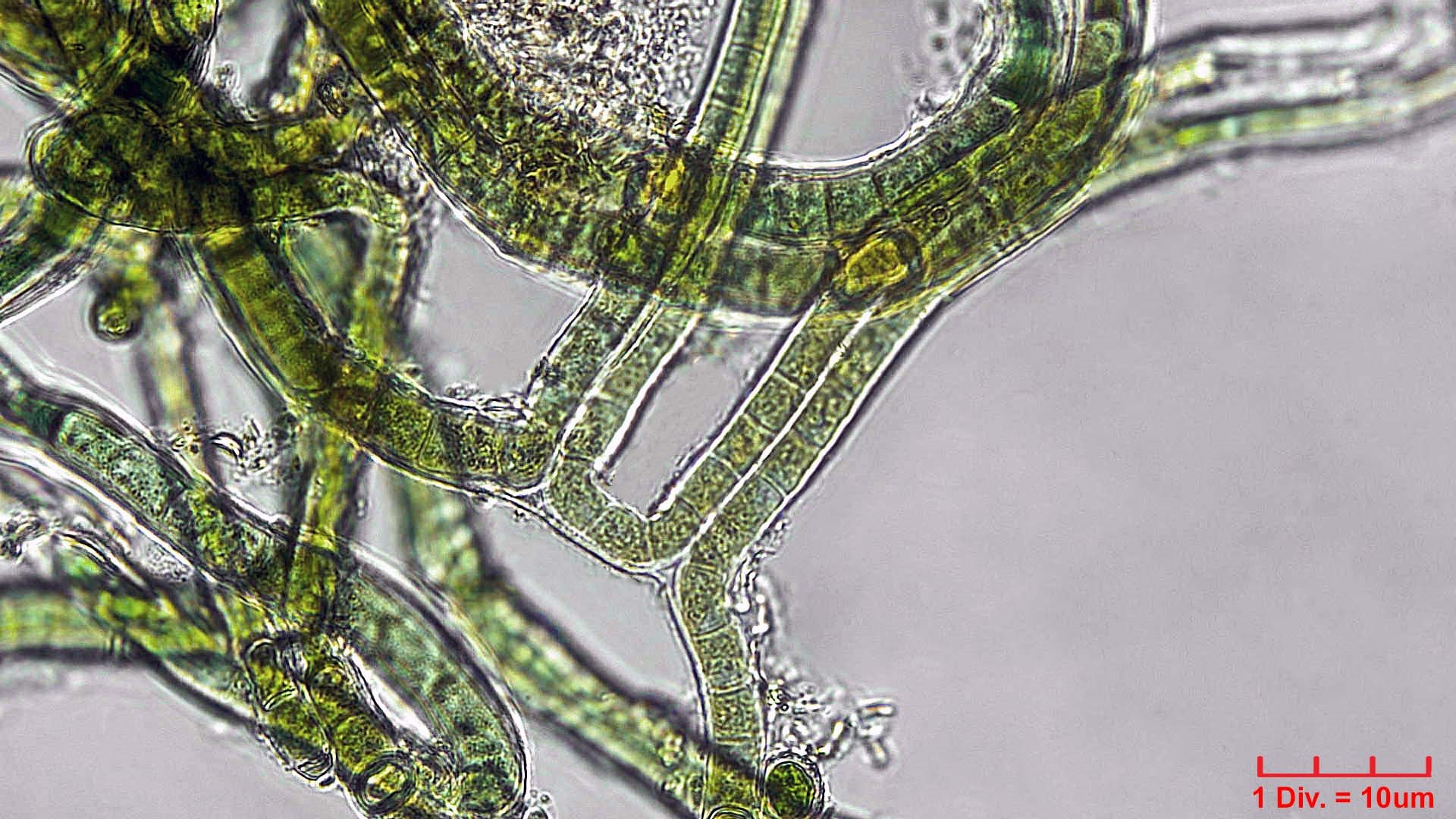 Cyanobacteria/Nostocales/Scytonemataceae/Scytonema/javanicum/scytonema-javanicum-399.jpg