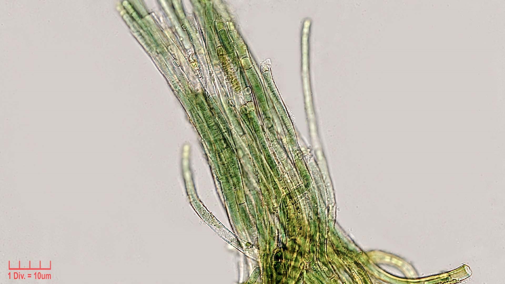 Cyanobacteria/Nostocales/Scytonemataceae/Scytonema/javanicum/scytonema-javanicum-400.jpg