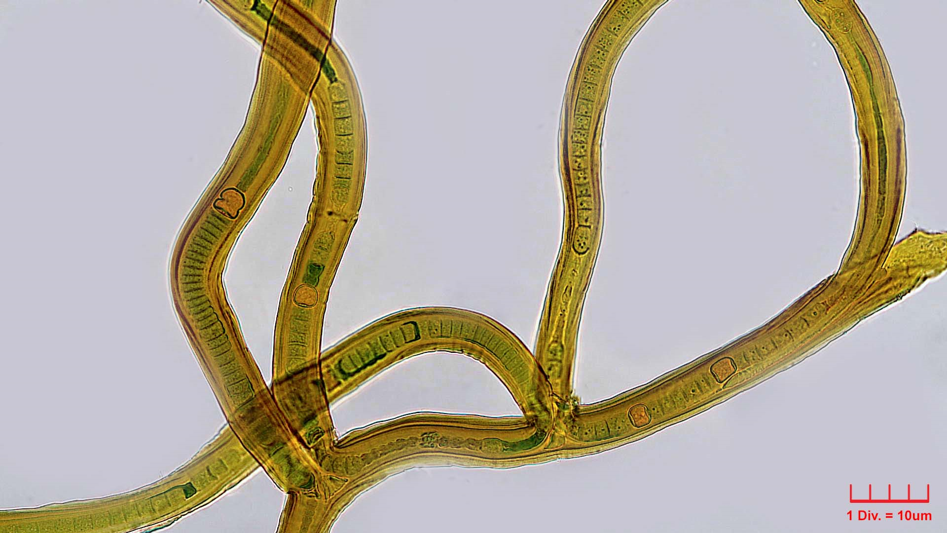 Cyanobacteria/Nostocales/Scytonemataceae/Scytonema/myochrous/scytonema-mychrous-373.png