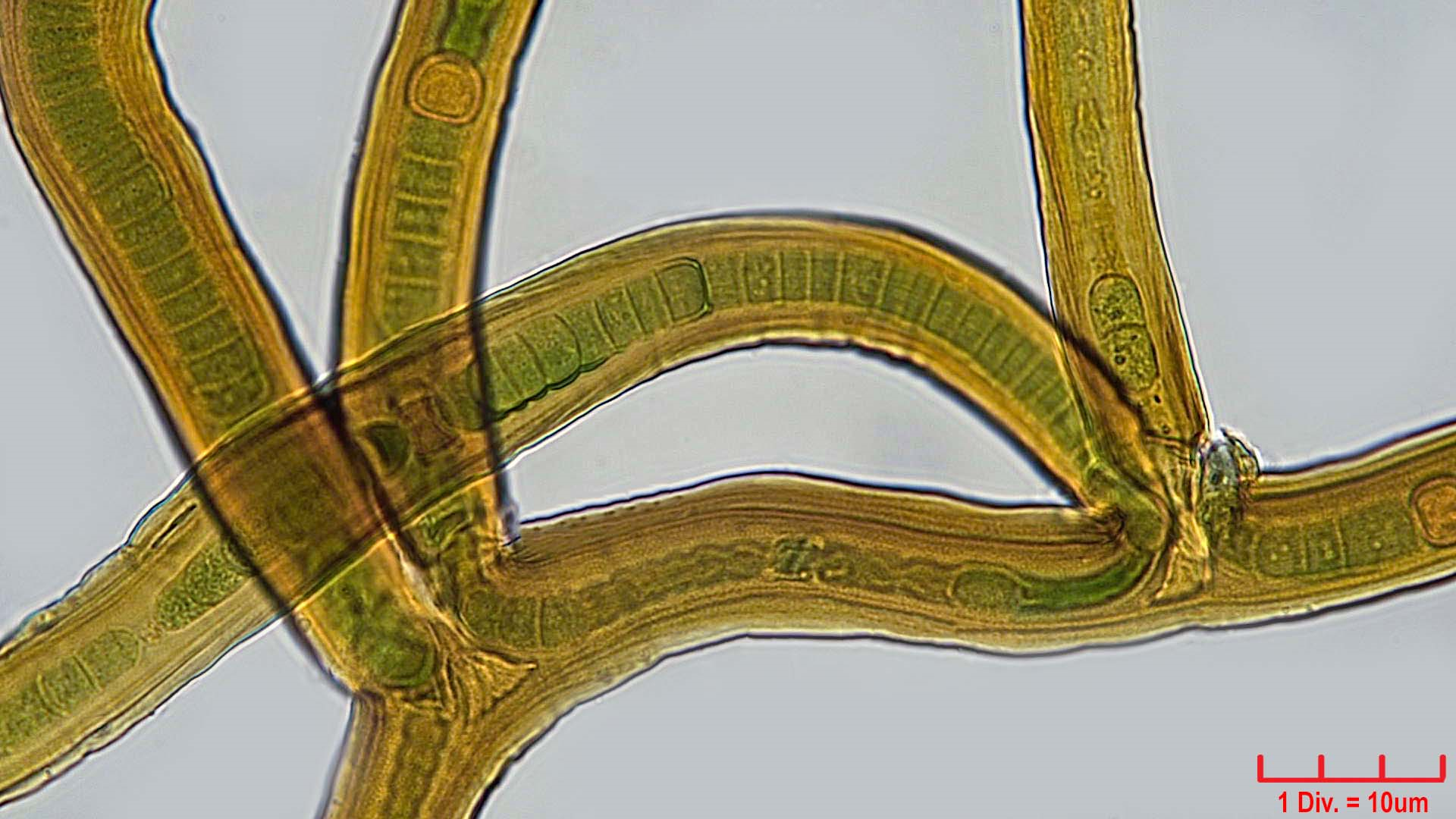 Cyanobacteria/Nostocales/Scytonemataceae/Scytonema/myochrous/scytonema-mychrous-375.png