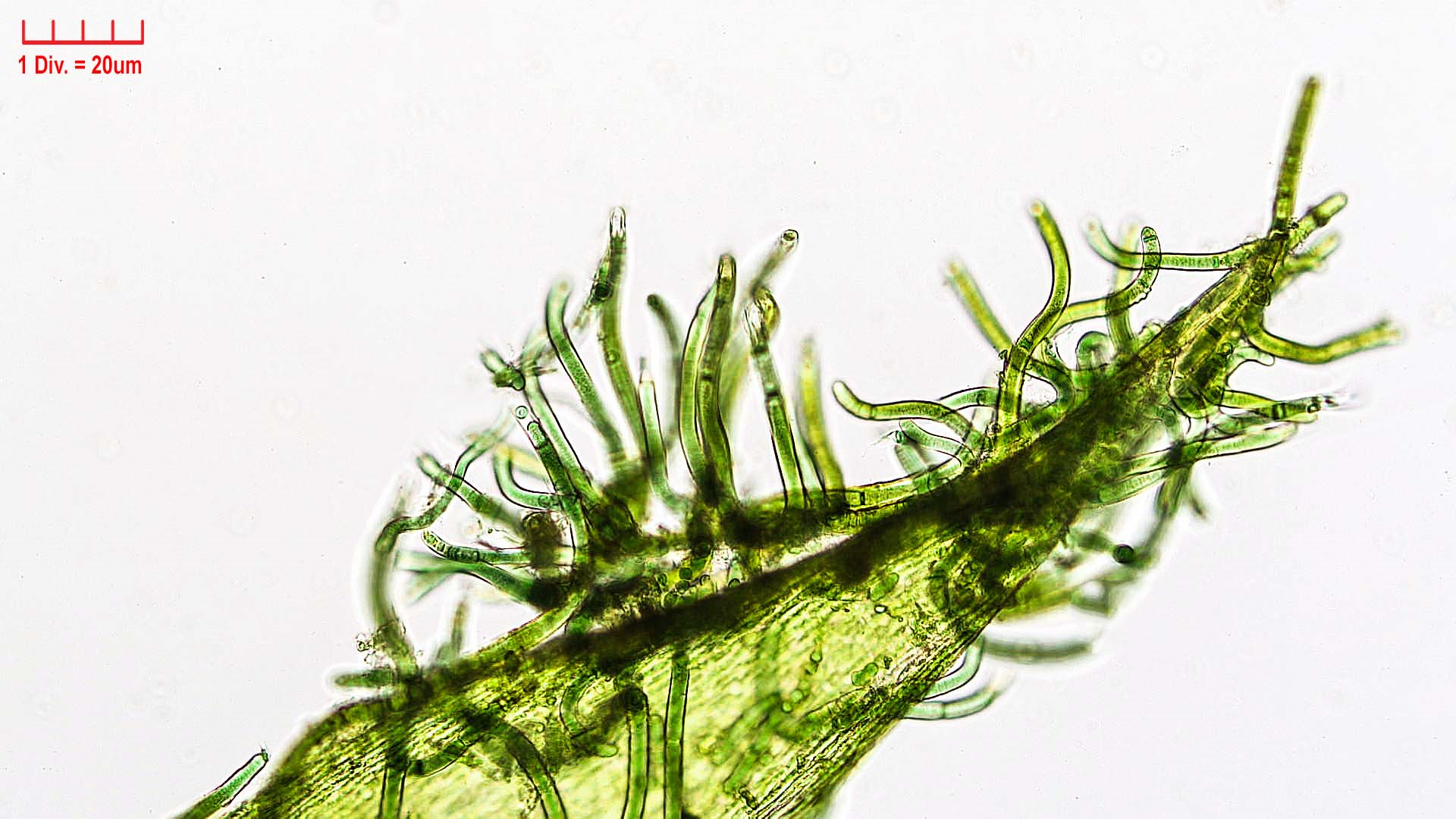 Cyanobacteria/Nostocales/Scytonemataceae/Scytonema/ocellatum/scytonema-ocellatum-381.png