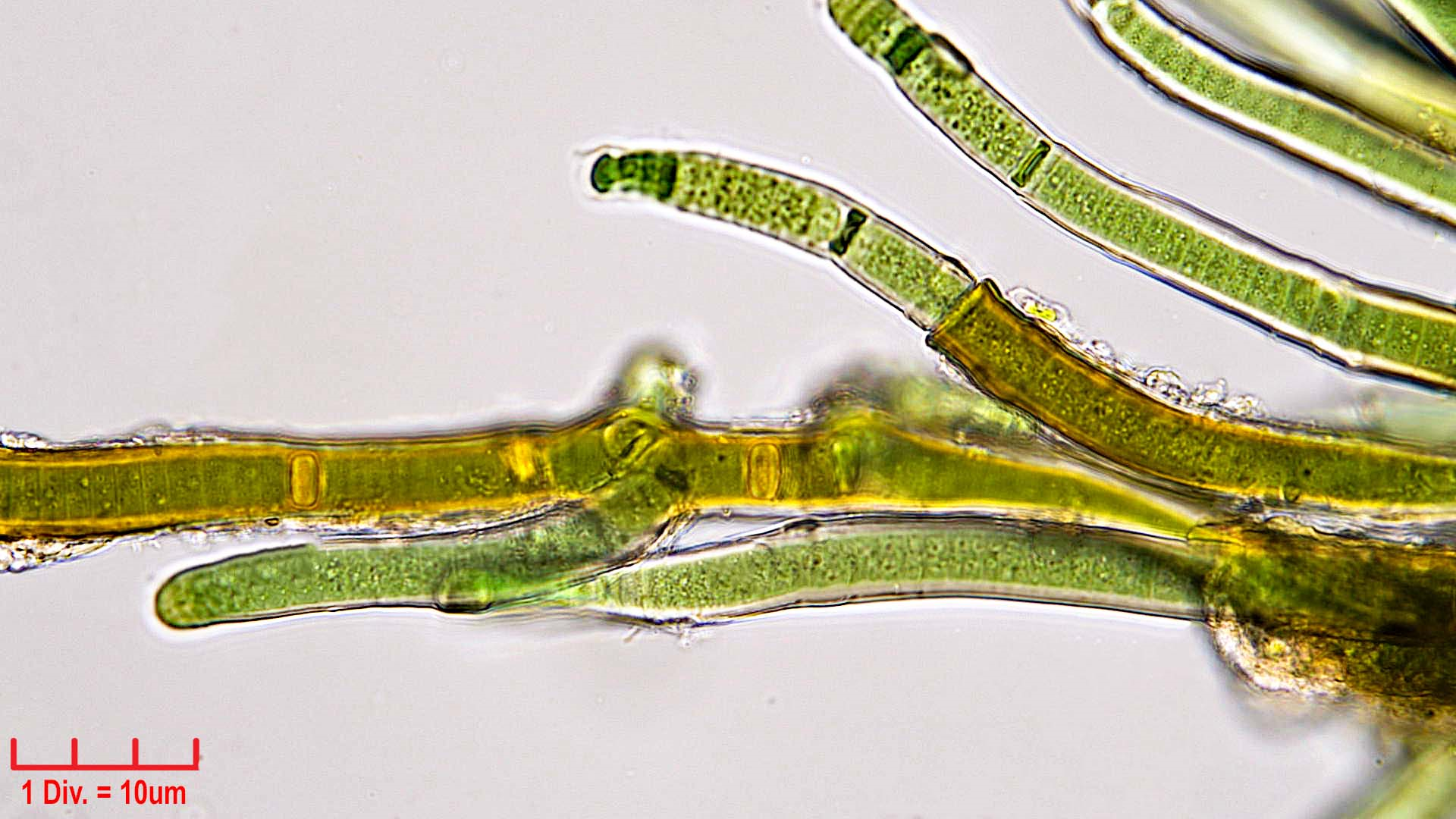 Cyanobacteria/Nostocales/Scytonemataceae/Scytonema/ocellatum/scytonema-ocellatum-382.png