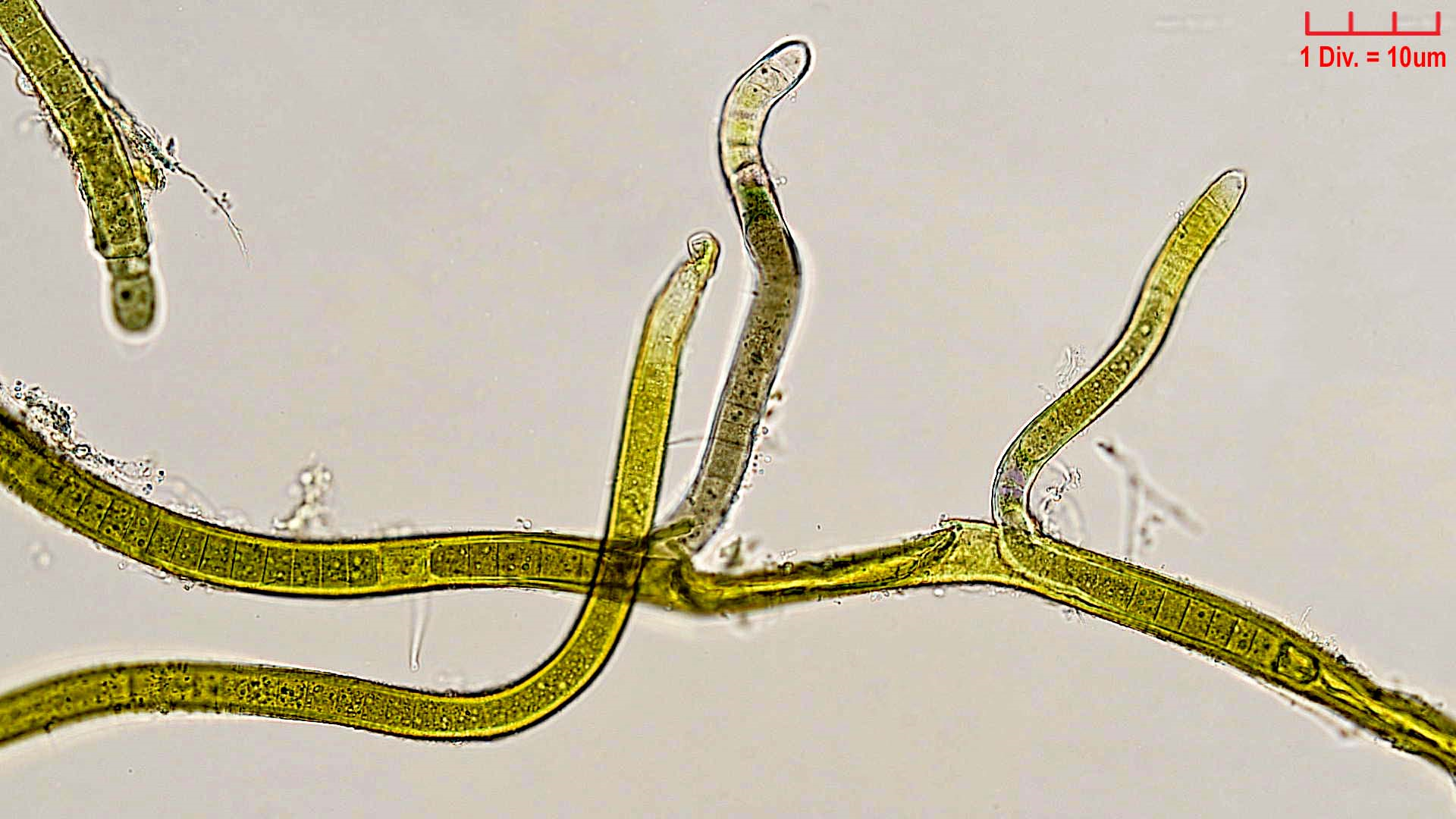 Cyanobacteria/Nostocales/Scytonemataceae/Scytonema/ocellatum/scytonema-ocellatum-383.png