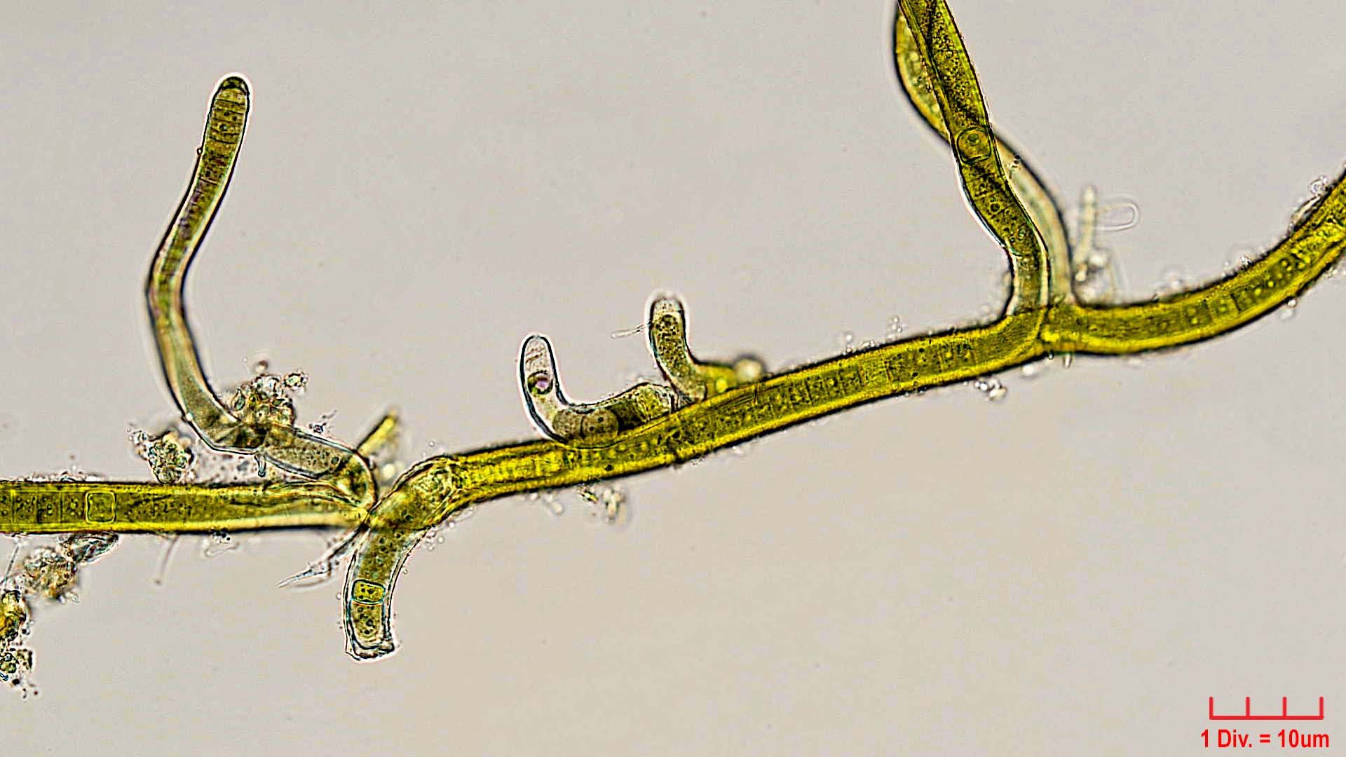 ./Cyanobacteria/Nostocales/Scytonemataceae/Scytonema/ocellatum/scytonema-ocellatum-384.png