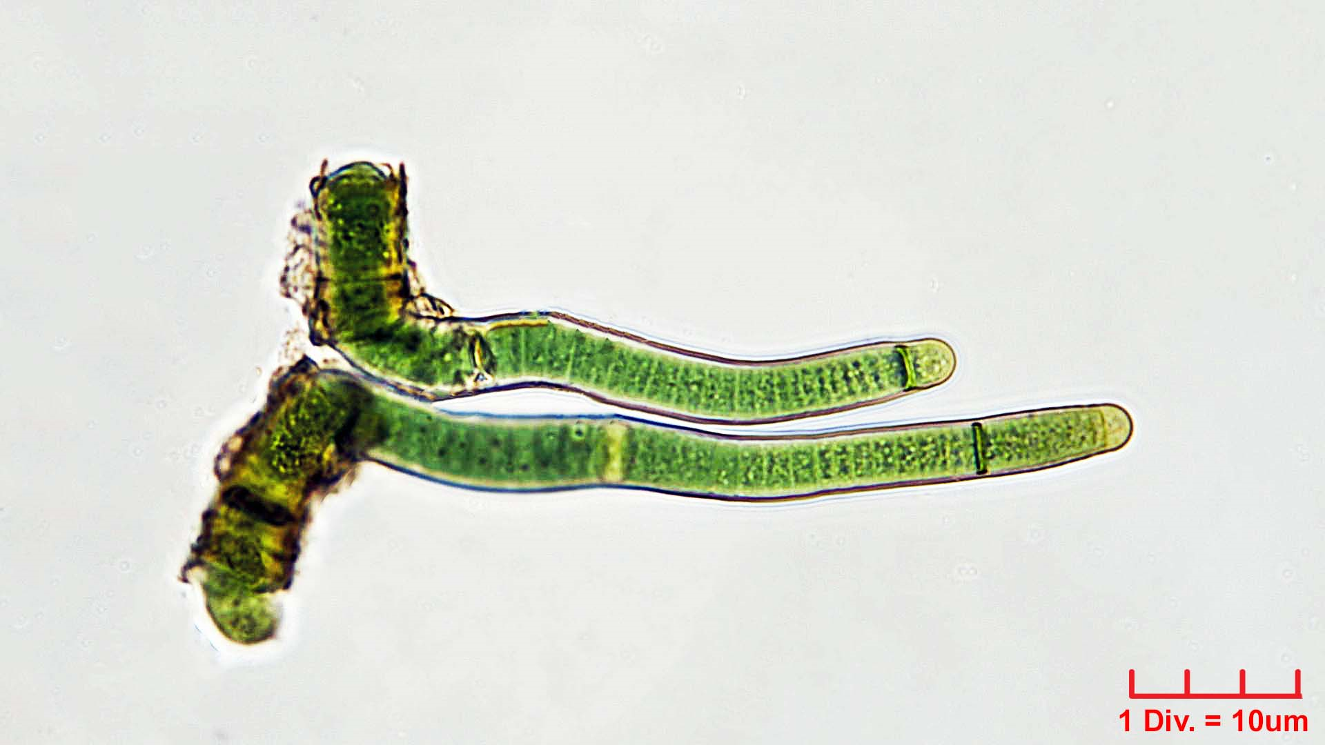 Cyanobacteria/Nostocales/Scytonemataceae/Scytonema/ocellatum/scytonema-ocellatum-385.png