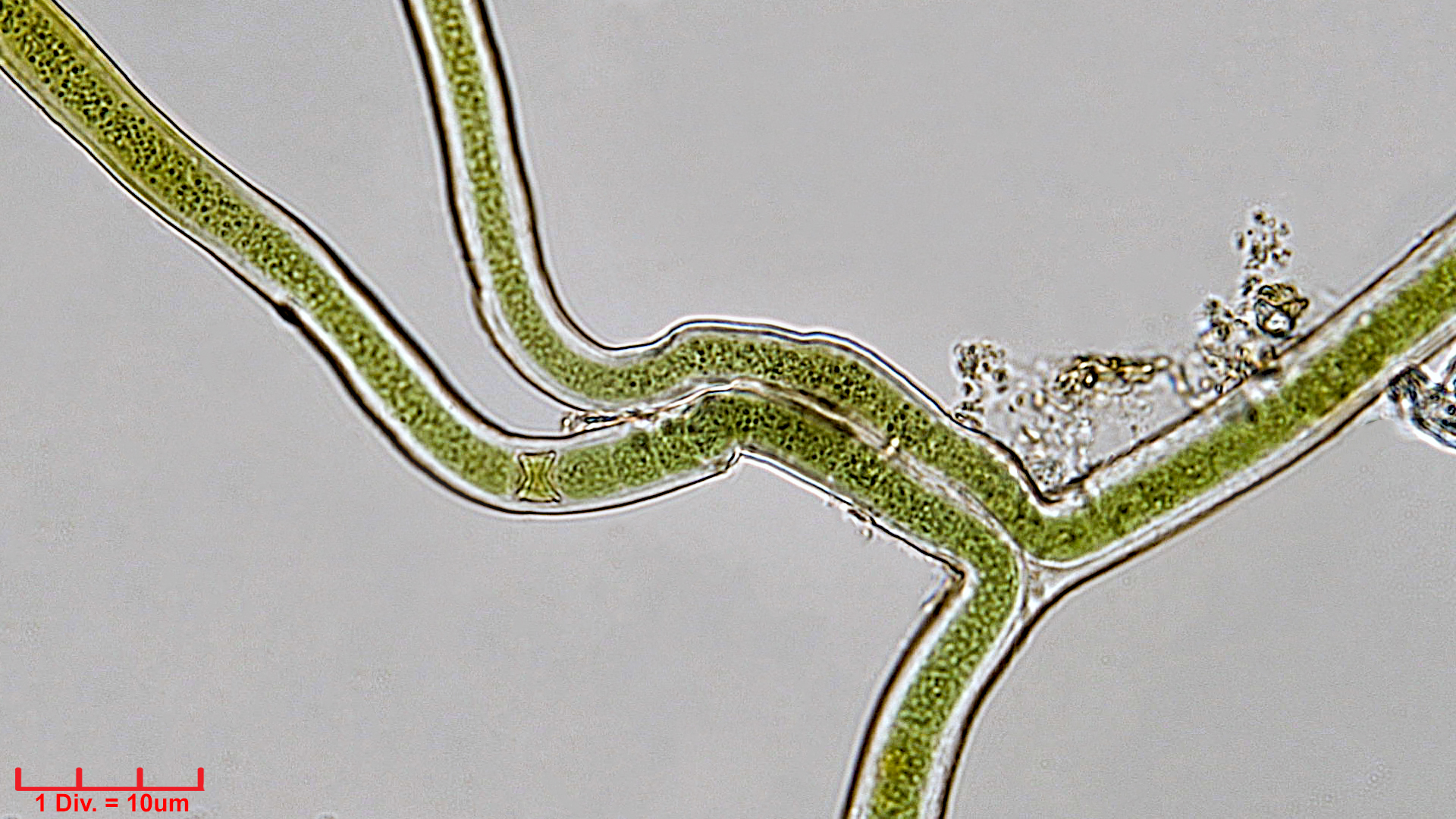 ./Cyanobacteria/Nostocales/Scytonemataceae/Scytonema/tolypothrichoides/scy-tolypothrichoides-405.jpg