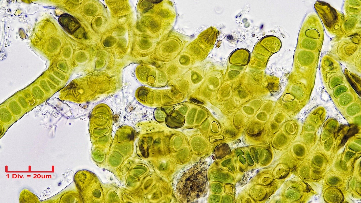 ./Cyanobacteria/Nostocales/Stigonemataceae/Stigonema/informe/stigonema-informe-519.jpg