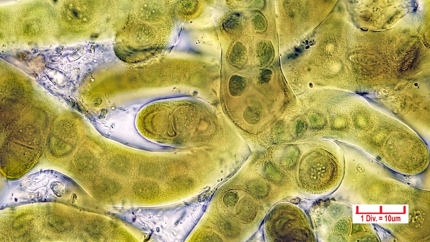 Cyanobacteria/Nostocales/Stigonemataceae/Stigonema/informe/stigonema-informe-520.jpg