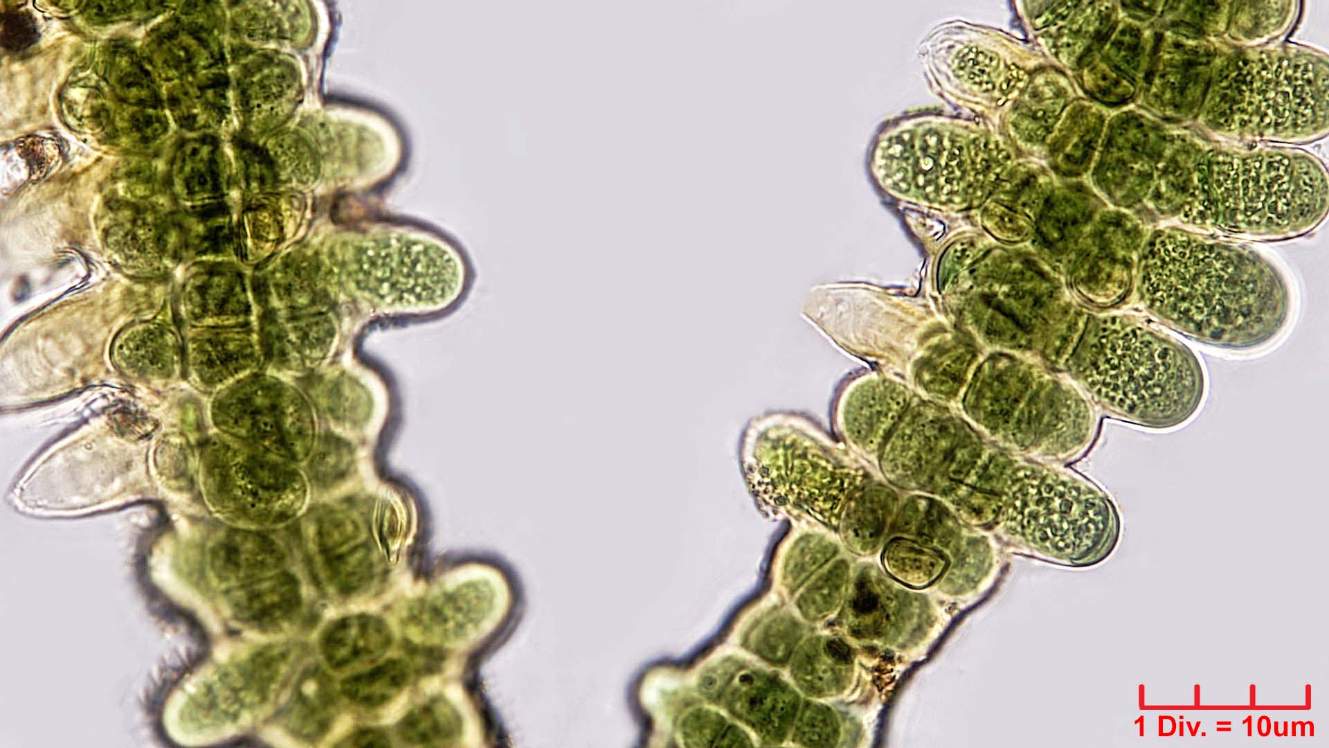 Cyanobacteria/Nostocales/Stigonemataceae/Stigonema/mamillosum/stigonema-mamillosum-541.jpg
