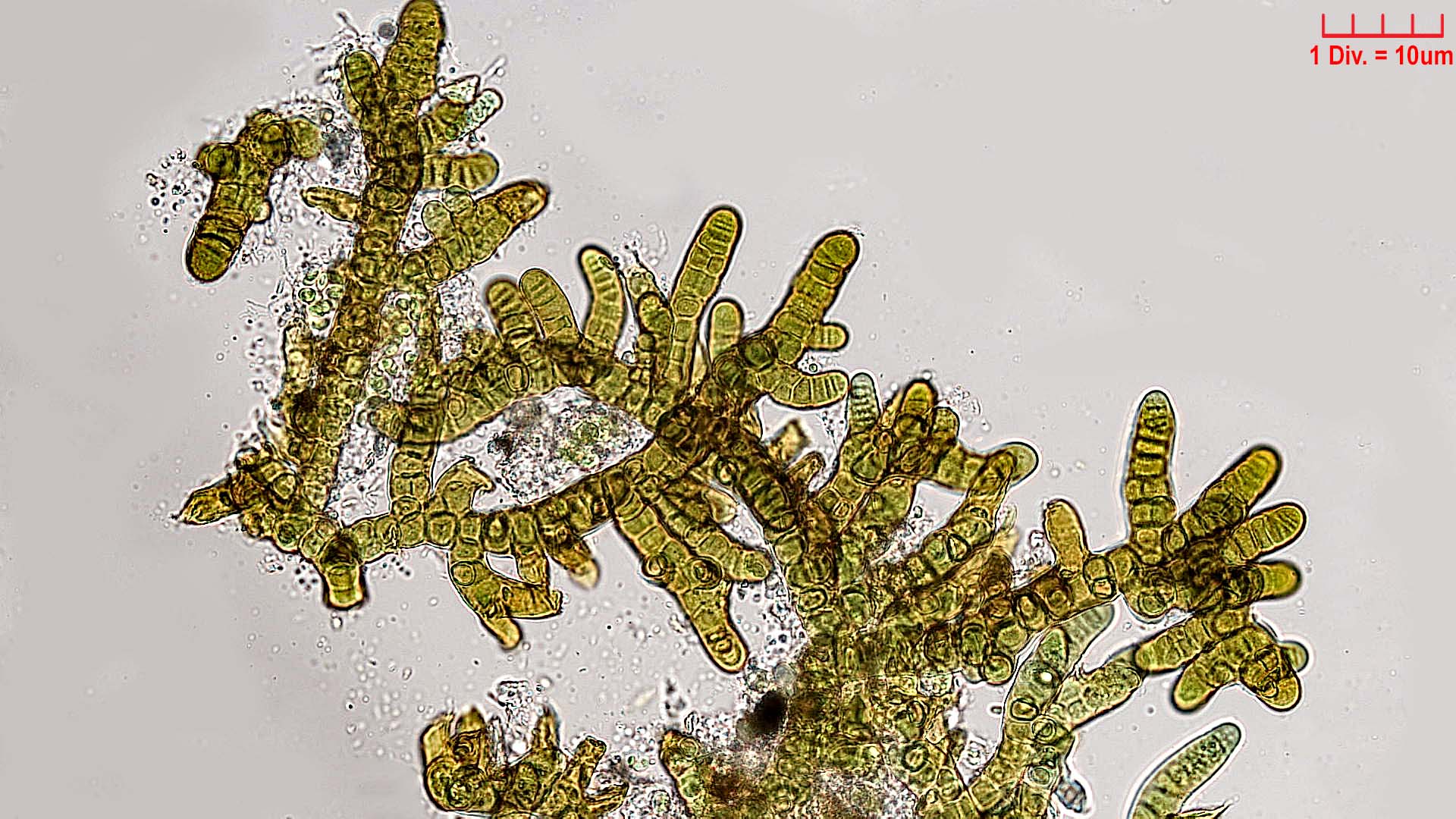 ./././Cyanobacteria/Nostocales/Stigonemataceae/Stigonema/minutum/stigonema-minutum-533.jpg