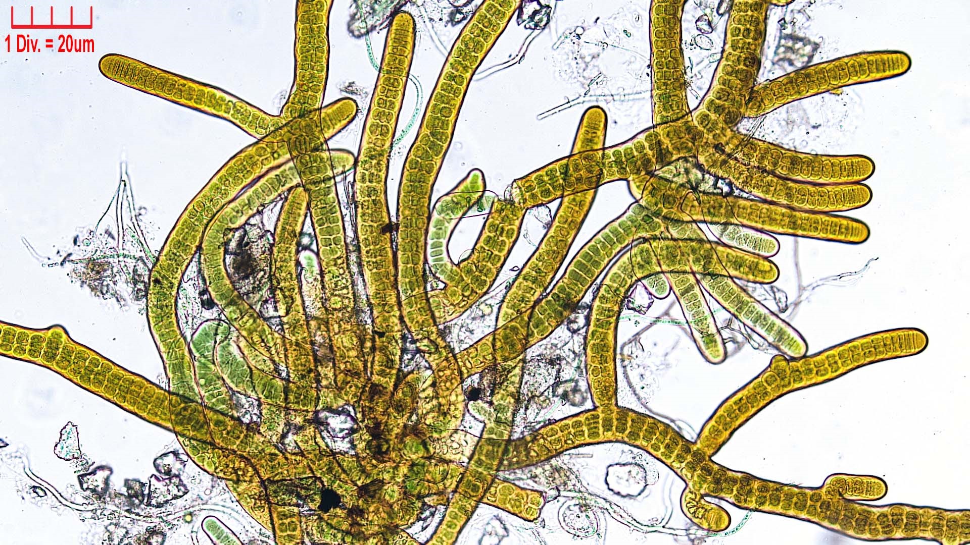 Cyanobacteria/Nostocales/Stigonemataceae/Stigonema/turfaceum/stigonema-turfaceum-522.jpg