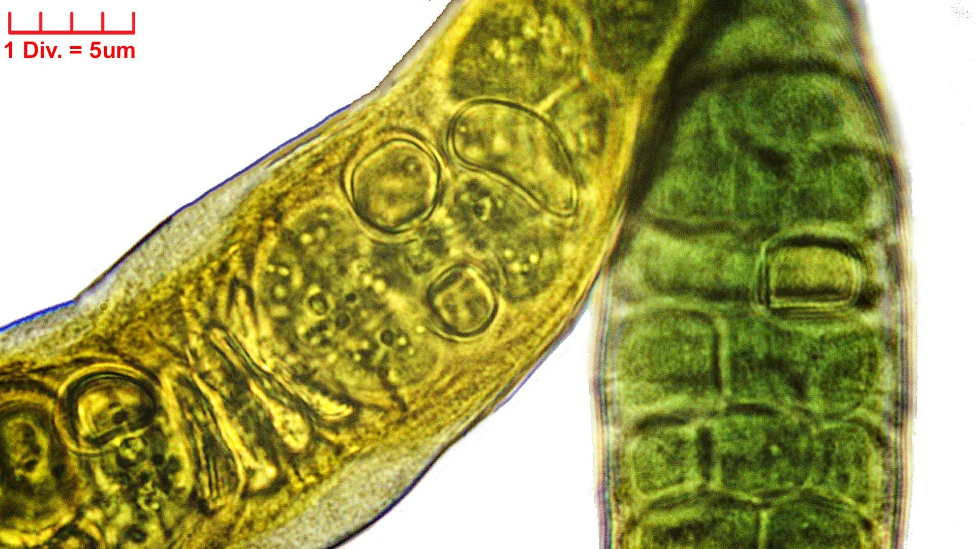 Cyanobacteria/Nostocales/Stigonemataceae/Stigonema/turfaceum/stigonema-turfaceum-525.jpg