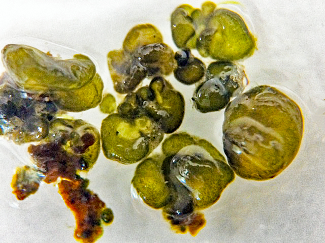Cyanobacteria/Nostocales/Symphyonemataceae/Brachytrichia/sp/brachytrichia-1.jpg
