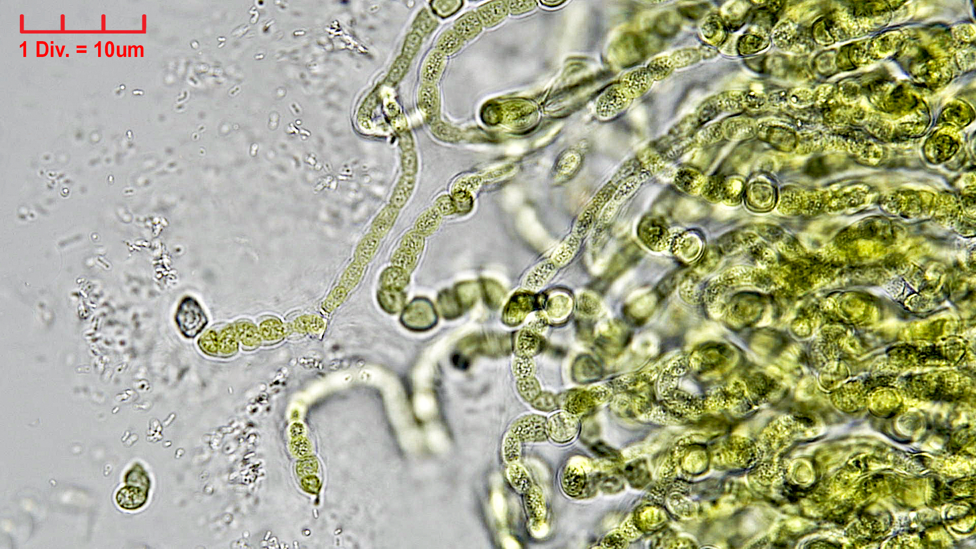 Cyanobacteria/Nostocales/Symphyonemataceae/Brachytrichia/sp/brachytrichia-4.jpg